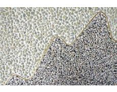 ˮϴʯ��ǽʩ��